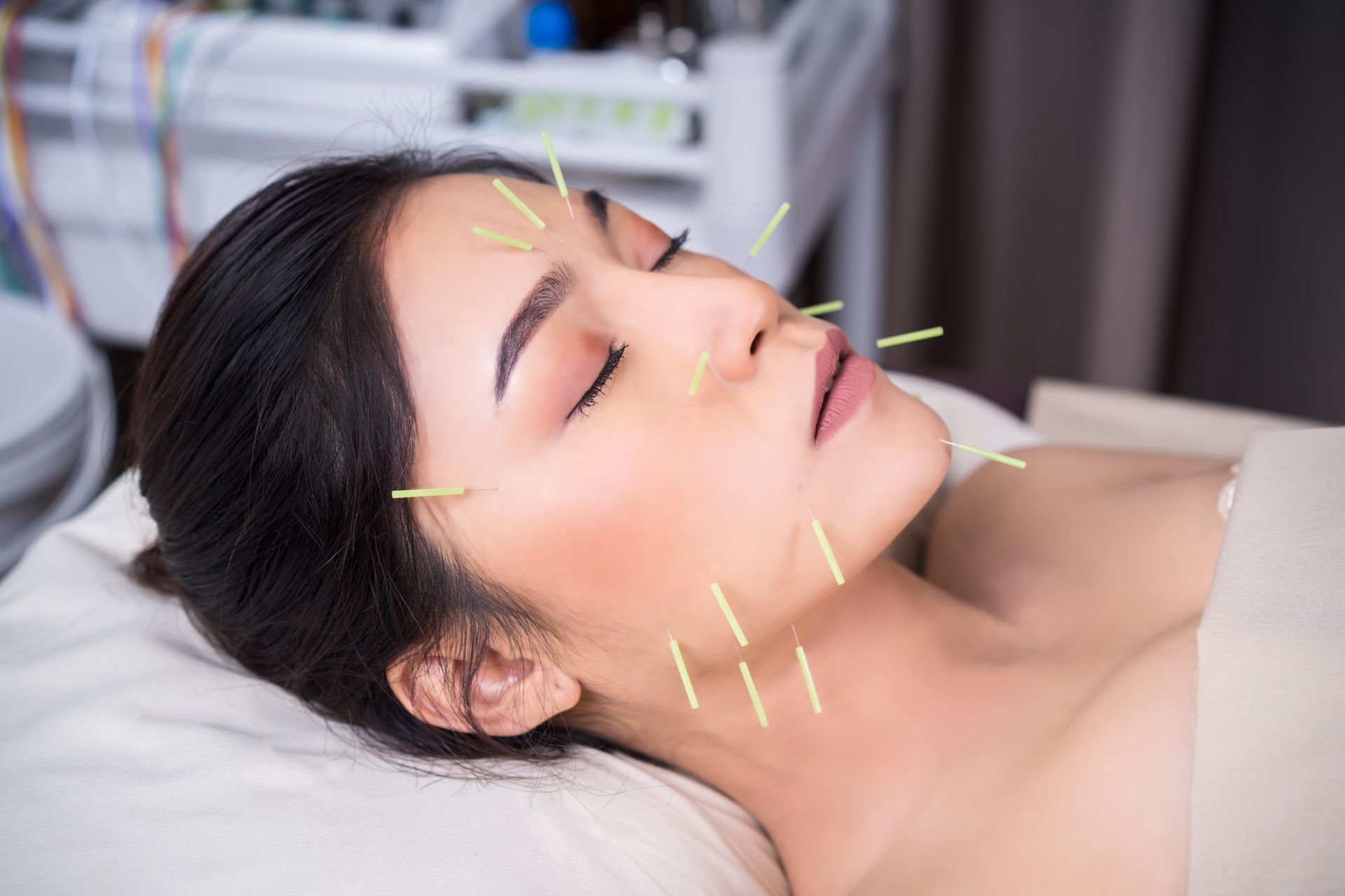 A woman is getting acupuncture on her face in a spa.