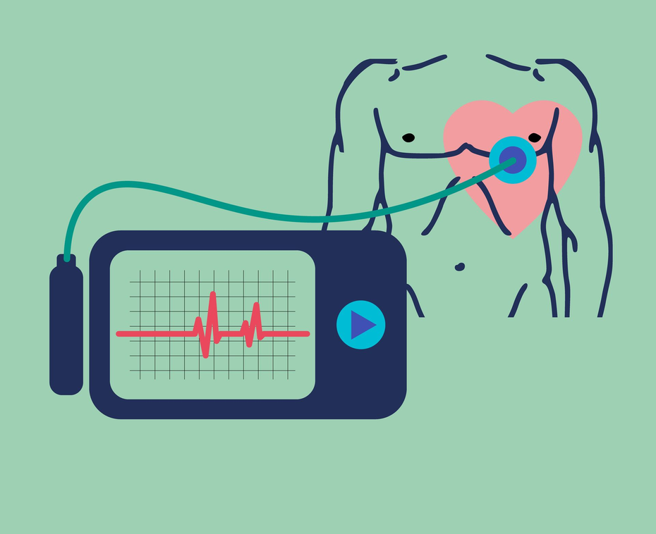 holter pressorio