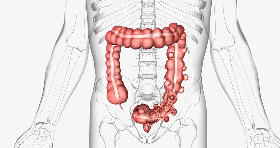 clisma opaco con doppio contrasto