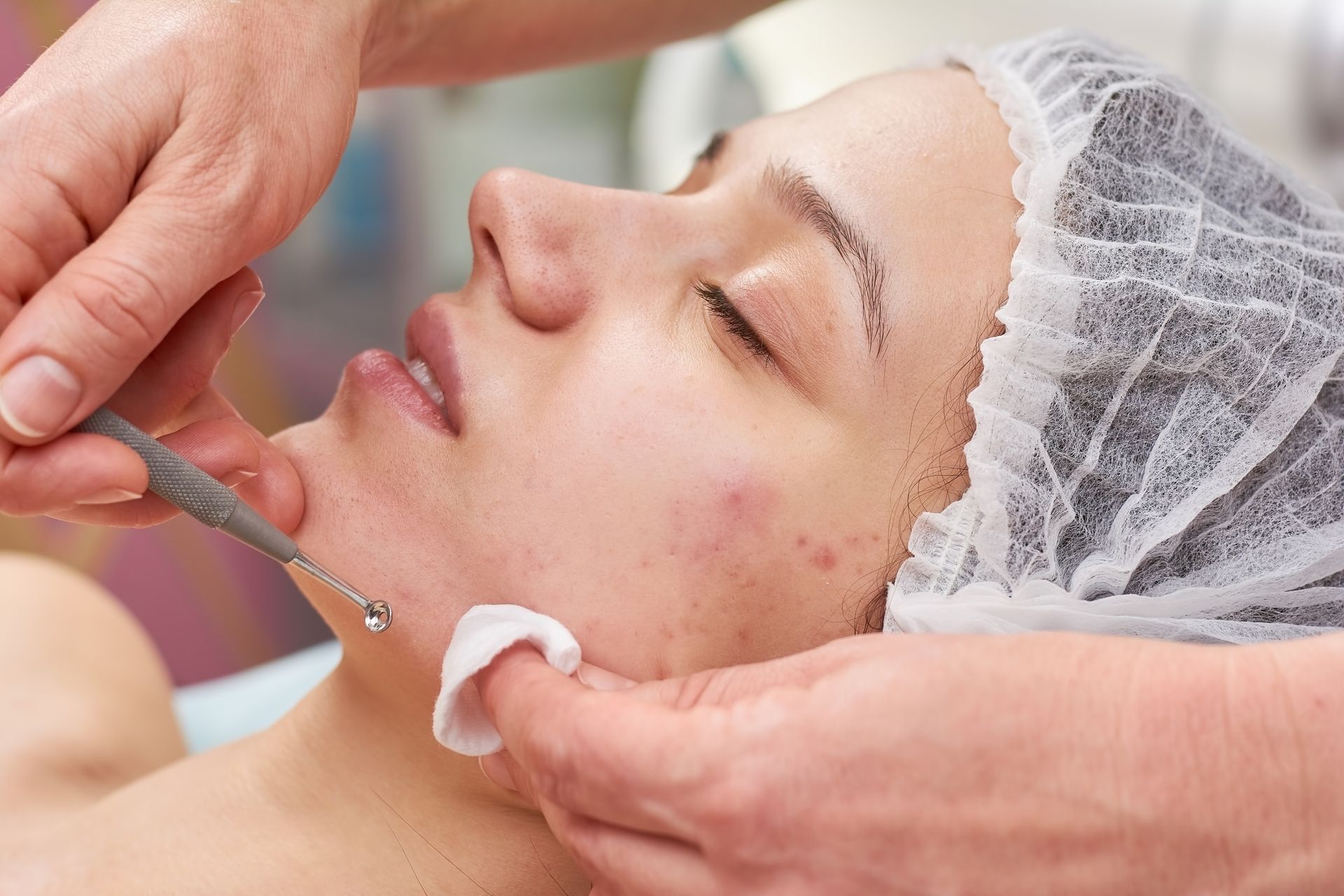 Professional dermatology services performing a facial extraction for acne treatment.