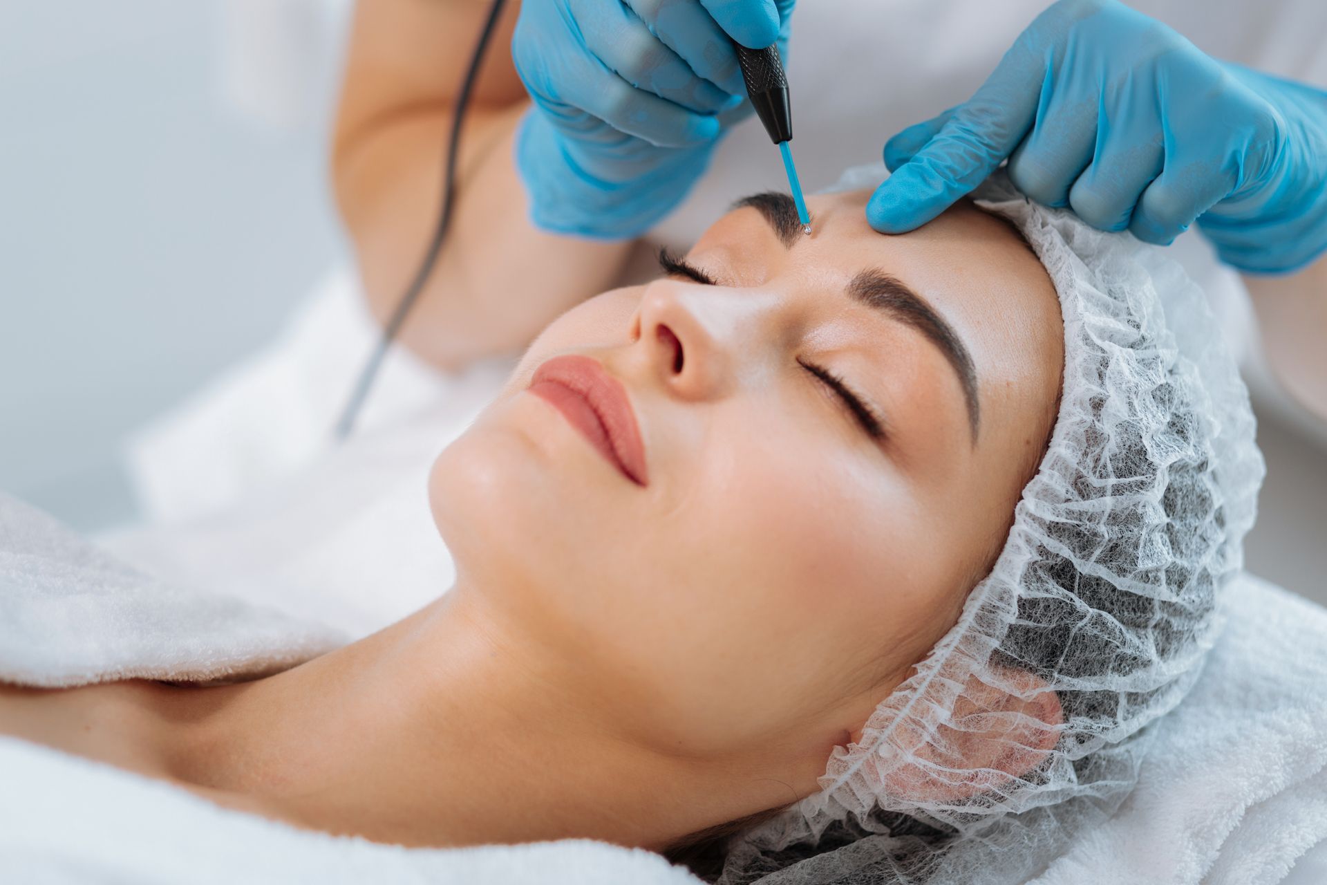 Dermatology specialist performing a cosmetic skin treatment on a patient's forehead.