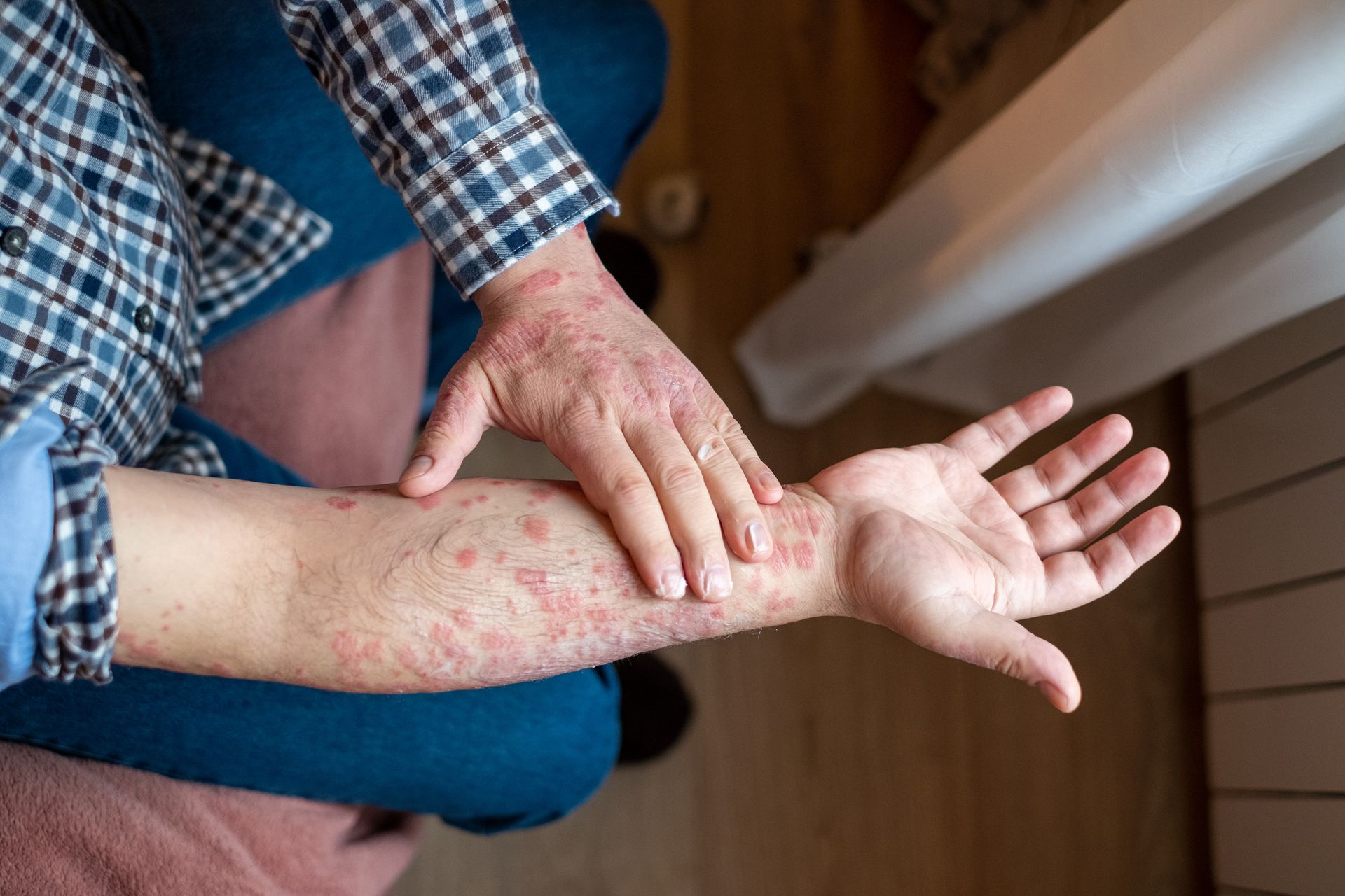 Man With Skin Problem – Athens, AL – Mallette Dermatology P.C.