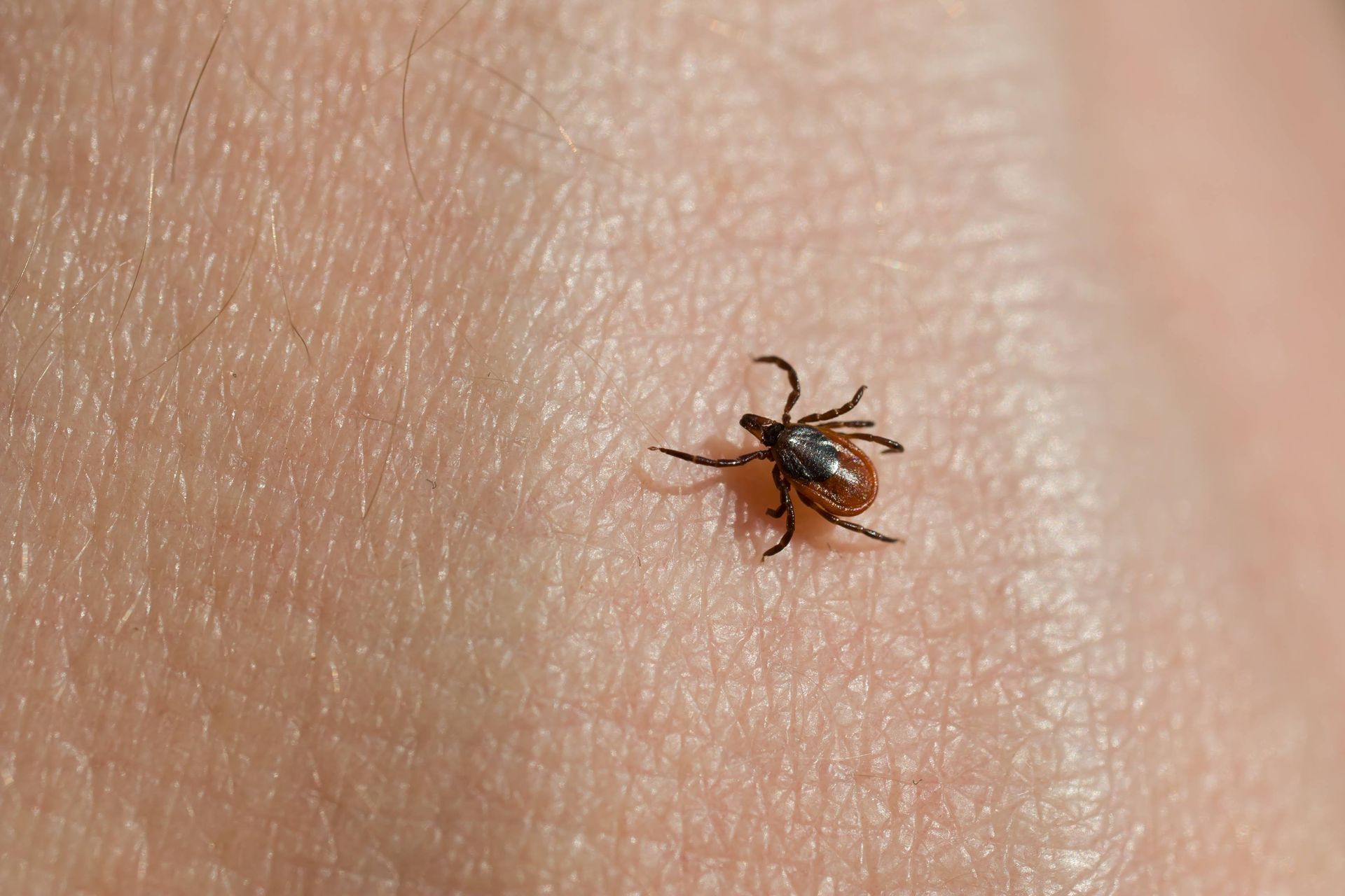 A black-legged deer tick on skin