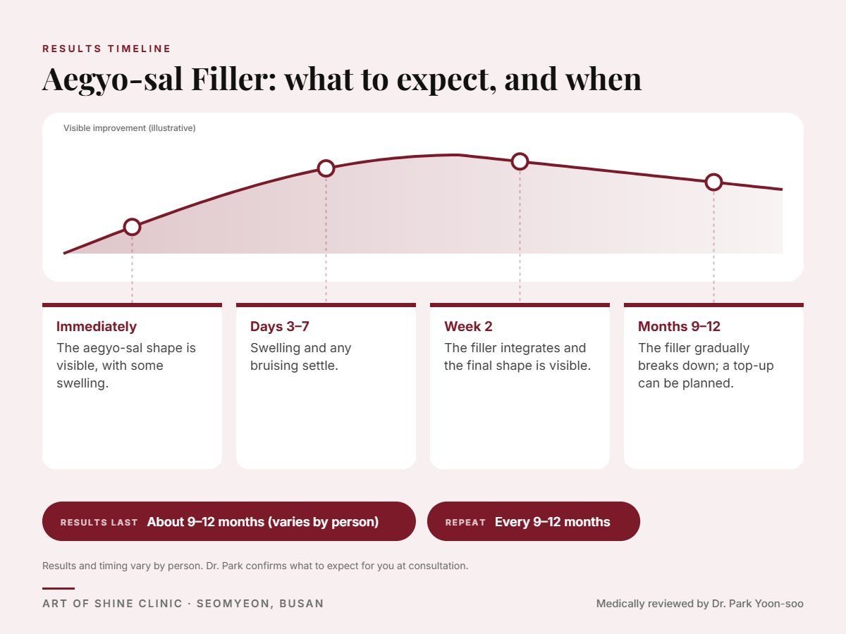 Aegyo-sal Filler results timeline: when results appear and peak, and how long they last (About 9&ndash;12 months)