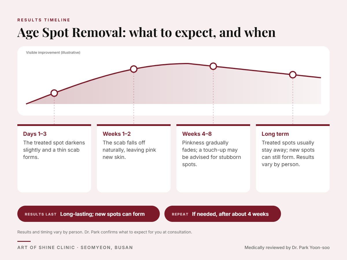 Age Spot Removal results timeline: when results appear and peak, and how long they last (Long-lasting; new spots can form)