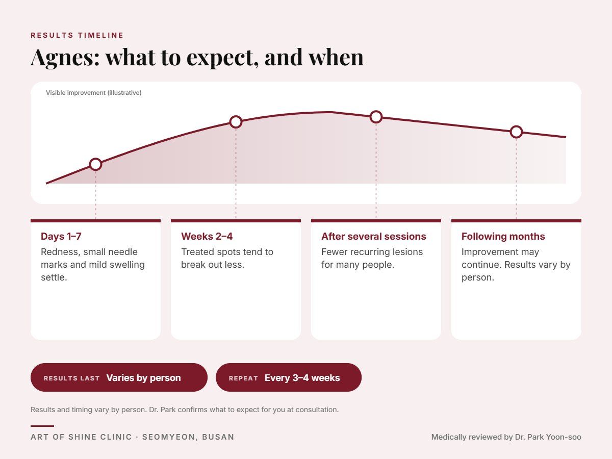 Agnes results timeline: when results appear and peak, and how long they last (Varies by person)