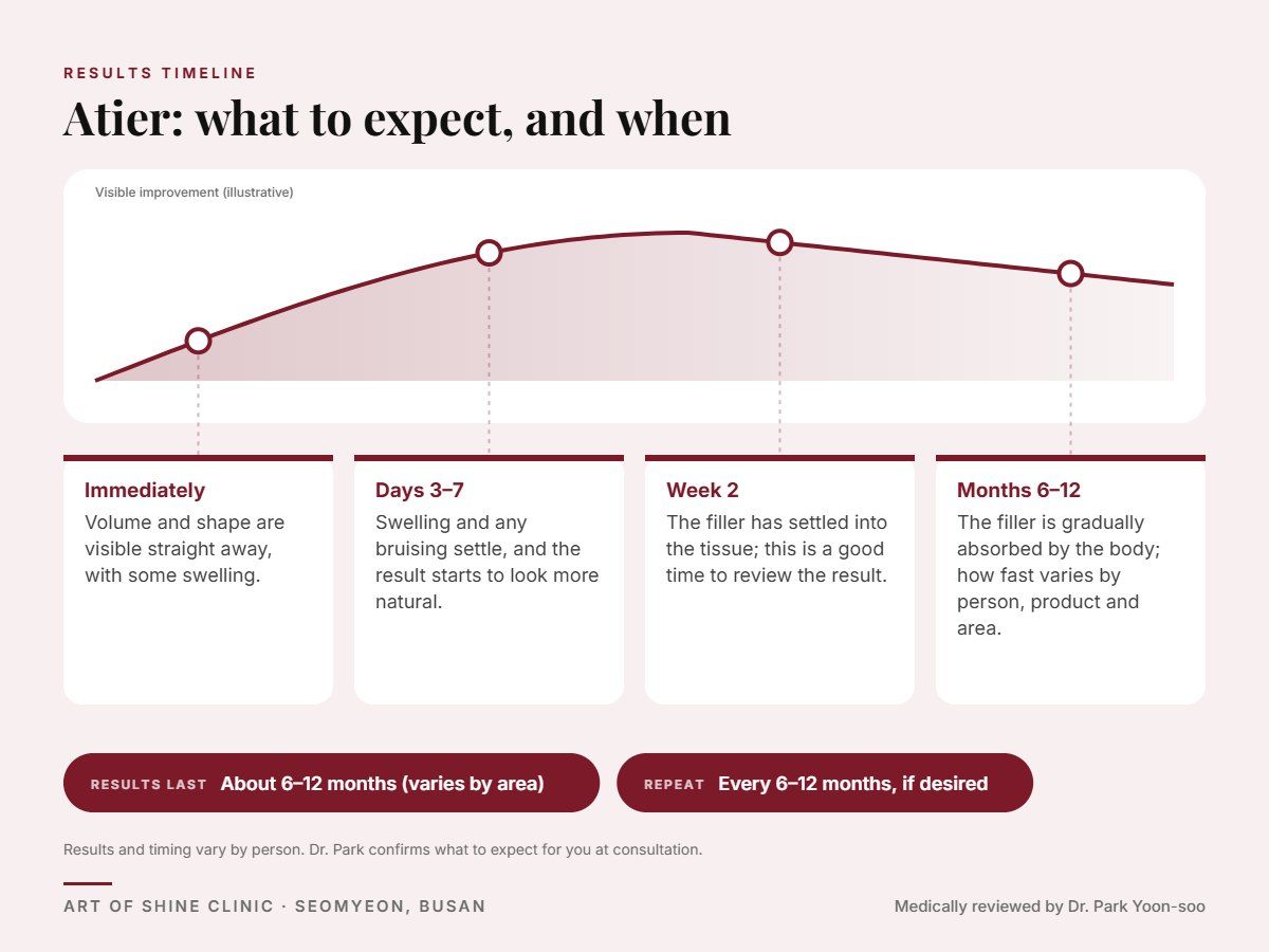 Atier results timeline: when results appear and peak, and how long they last (About 6&ndash;12 months (varies by area))