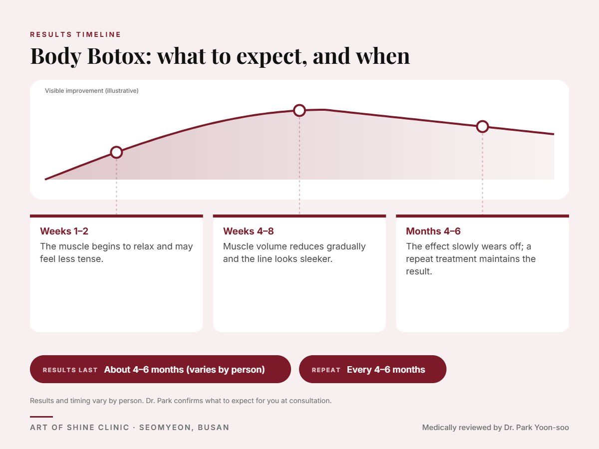 Body Botox results timeline: when results appear and peak, and how long they last (About 4&ndash;6 months)