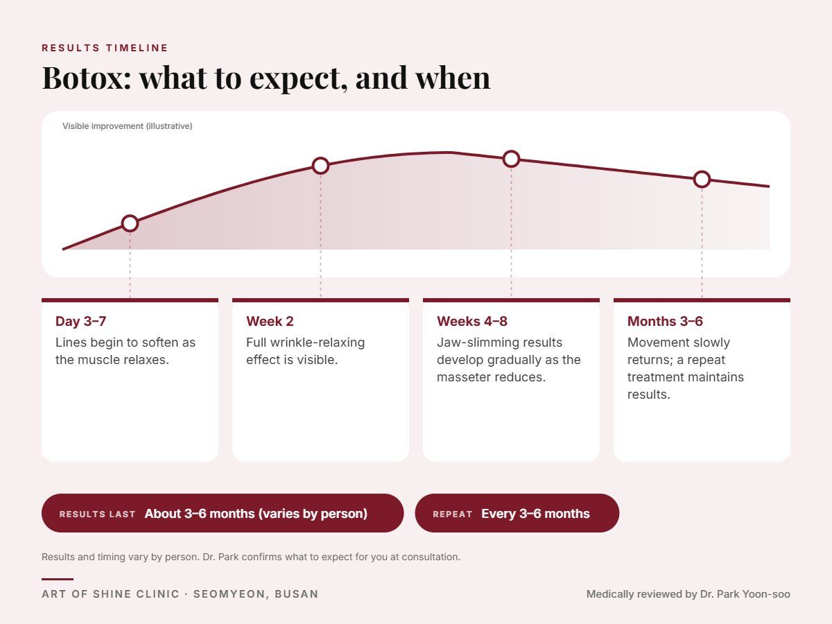 Botox results timeline: when results appear and peak, and how long they last (About 3&ndash;6 months)