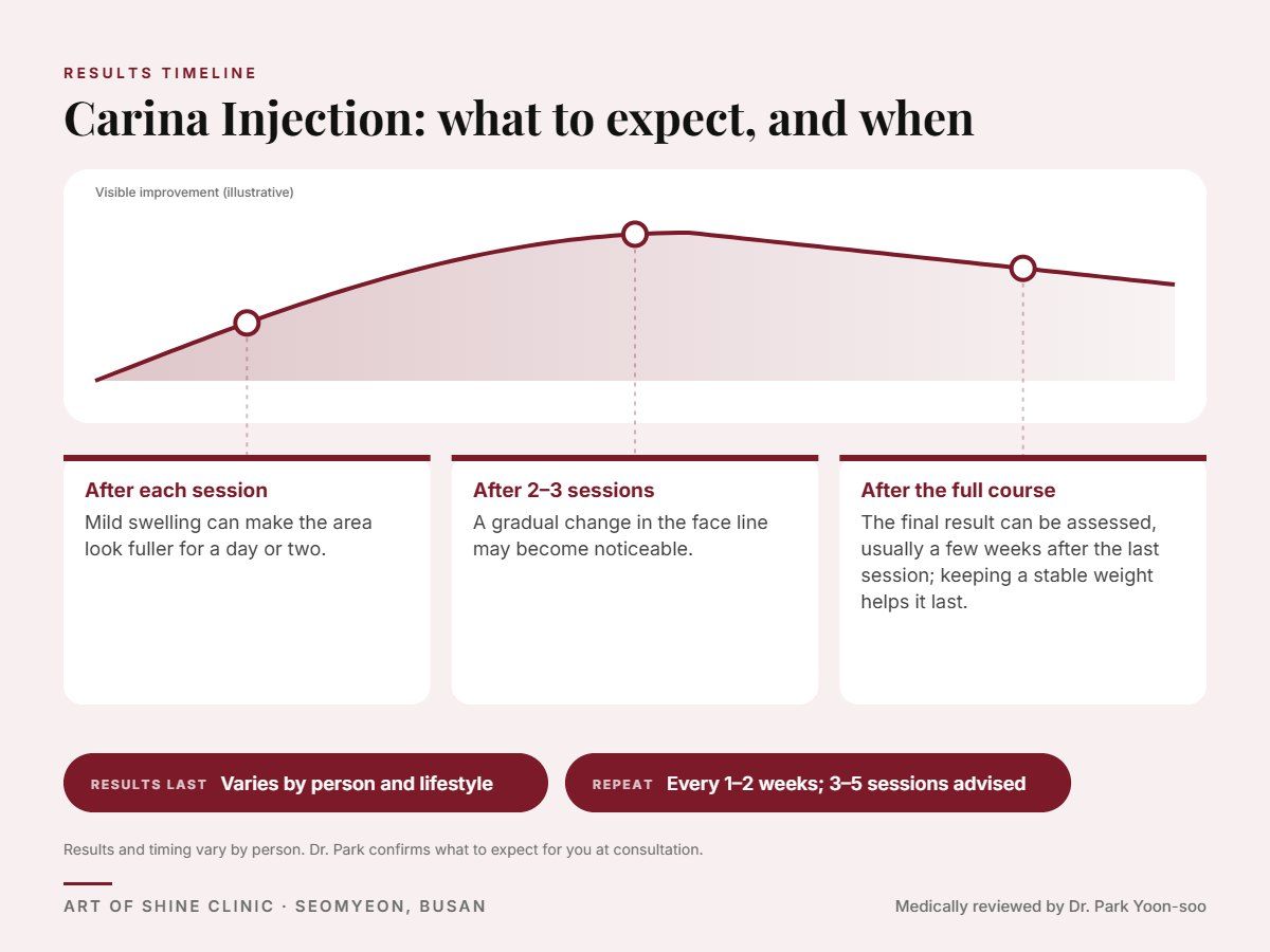 Carina Injection results timeline: when results appear and peak, and how long they last (Varies by person and lifestyle)