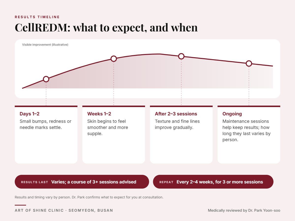 CellREDM results timeline: when results appear and peak, and how long they last (Varies; a course of 3+ sessions advised)