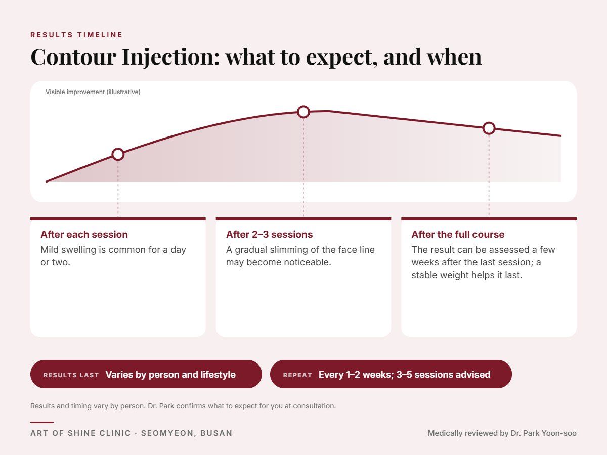 Contour Injection results timeline: when results appear and peak, and how long they last (Varies by person and lifestyle)