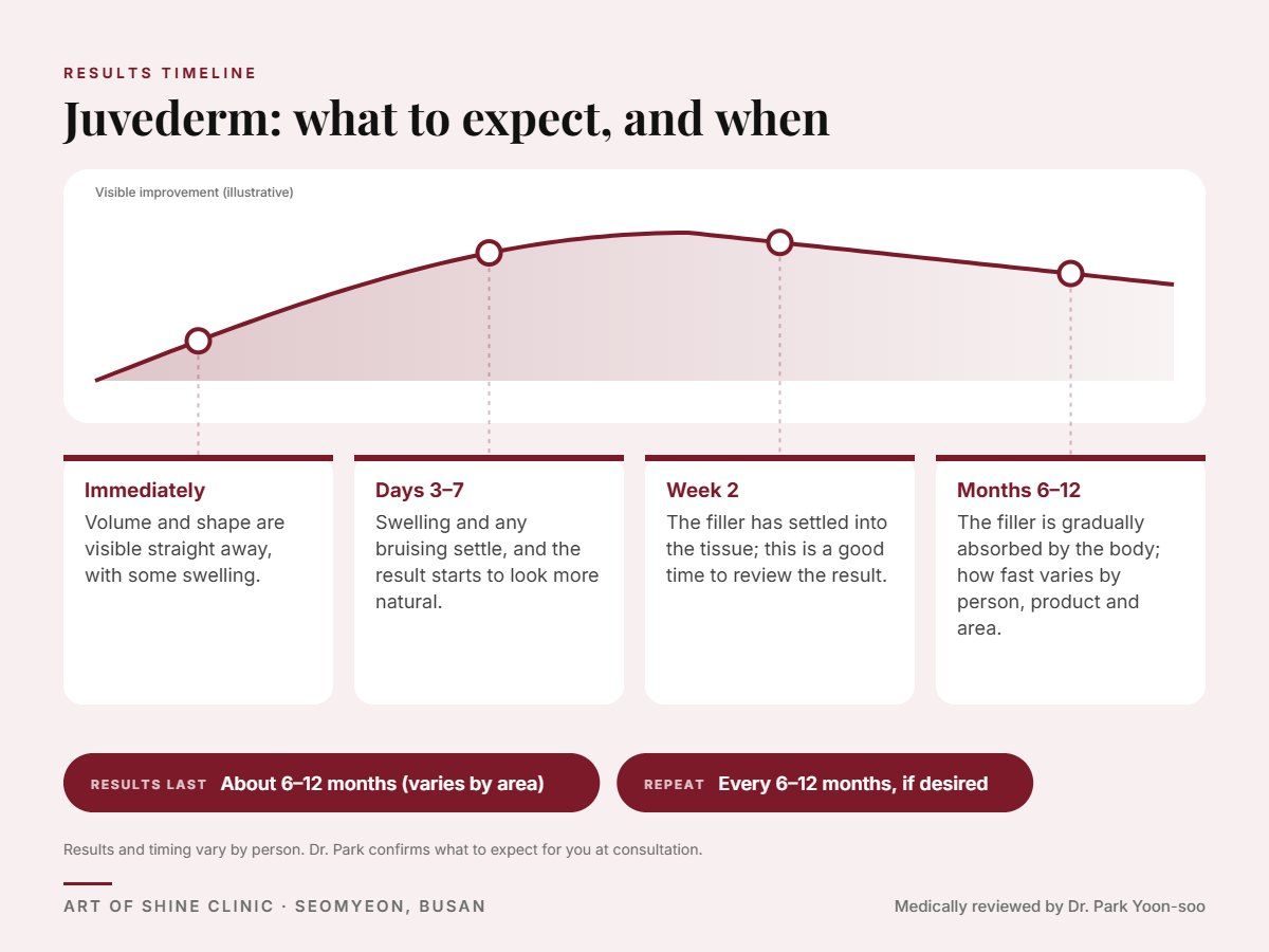 Juvederm results timeline: when results appear and peak, and how long they last (About 6&ndash;12 months (varies by area))