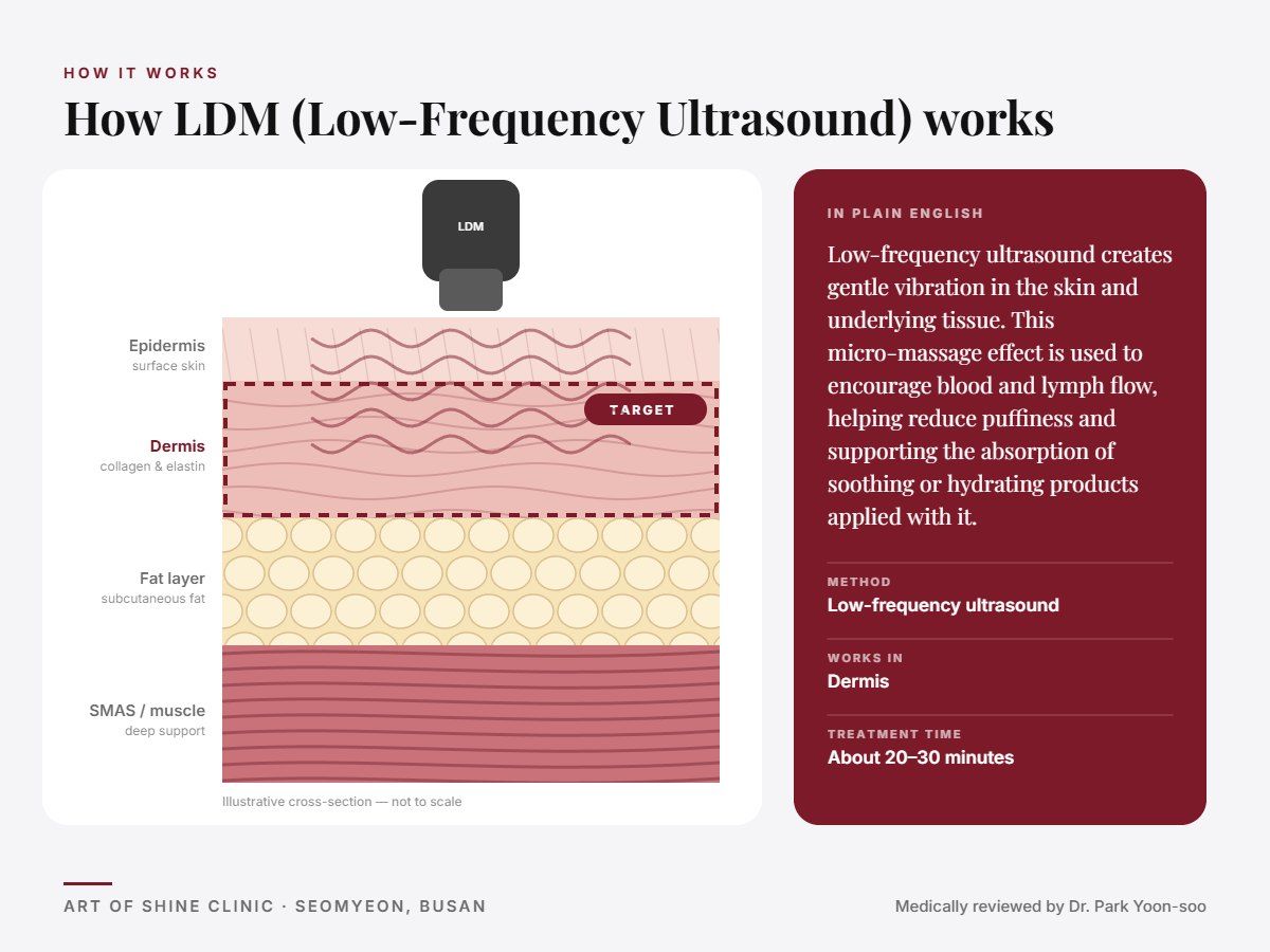 How LDM (Low-Frequency Ultrasound) works: illustrated skin cross-section showing low-frequency ultrasound reaching the dermis