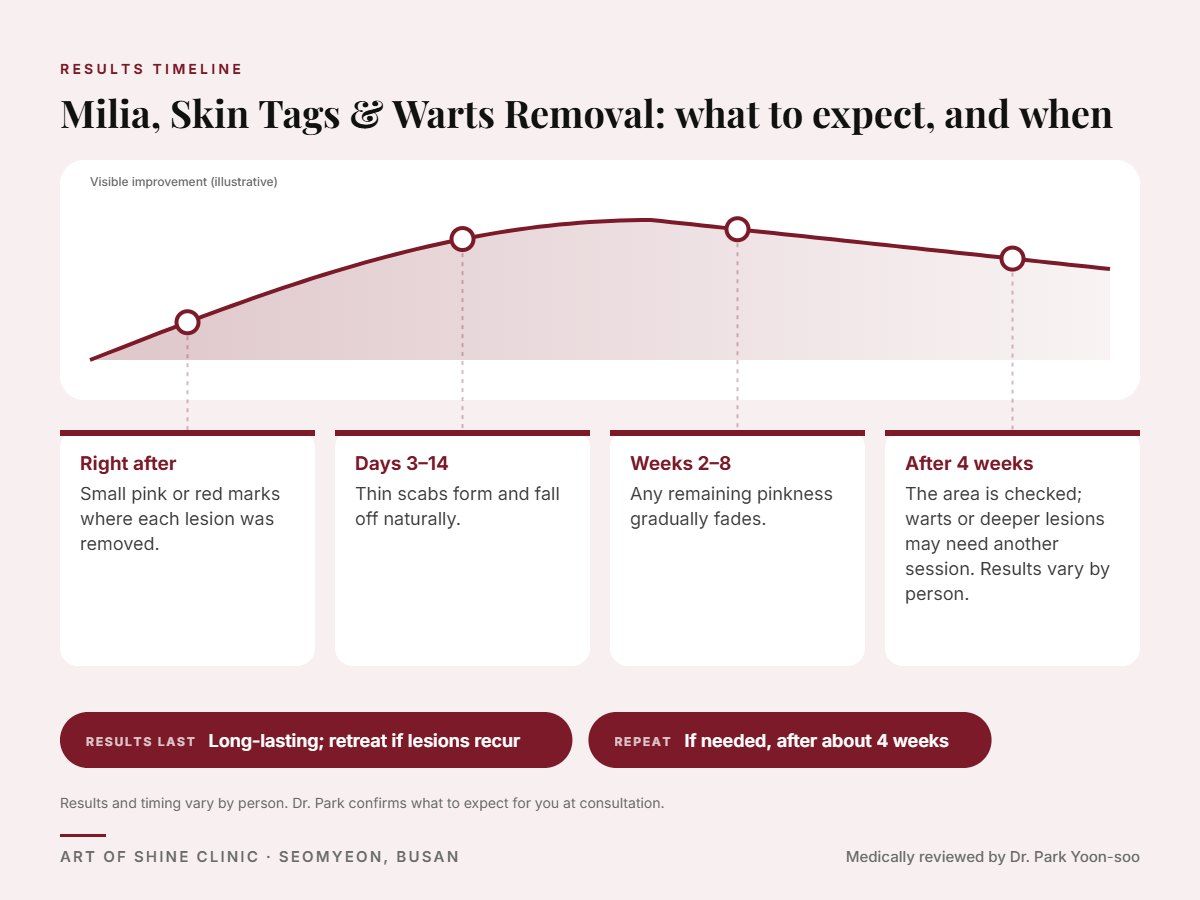 Milia, Skin Tags & Warts Removal results timeline: when results appear and peak, and how long they last (Long-lasting; retreat if lesions recur)