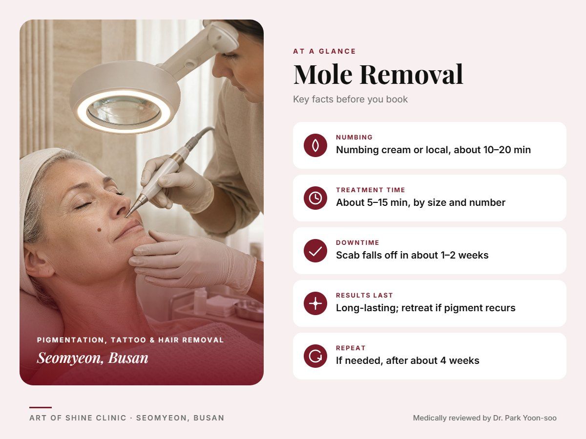 Mole Removal in Busan at a glance: numbing, treatment time (About 5&ndash;15 min, by size and number), downtime, how long results last and repeat interval, Art of Shine Clinic