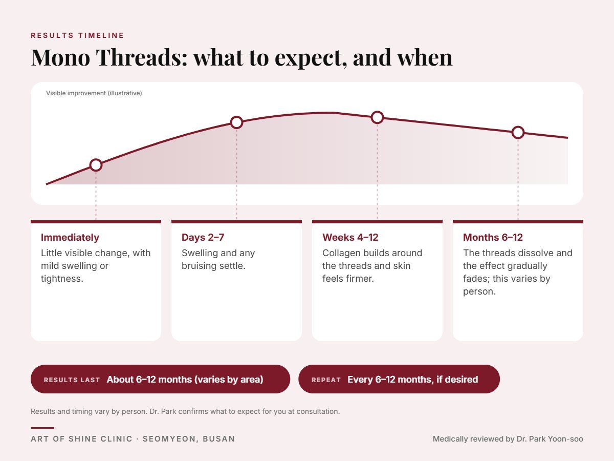 Mono Threads results timeline: when results appear and peak, and how long they last (About 6&ndash;12 months (varies by area))