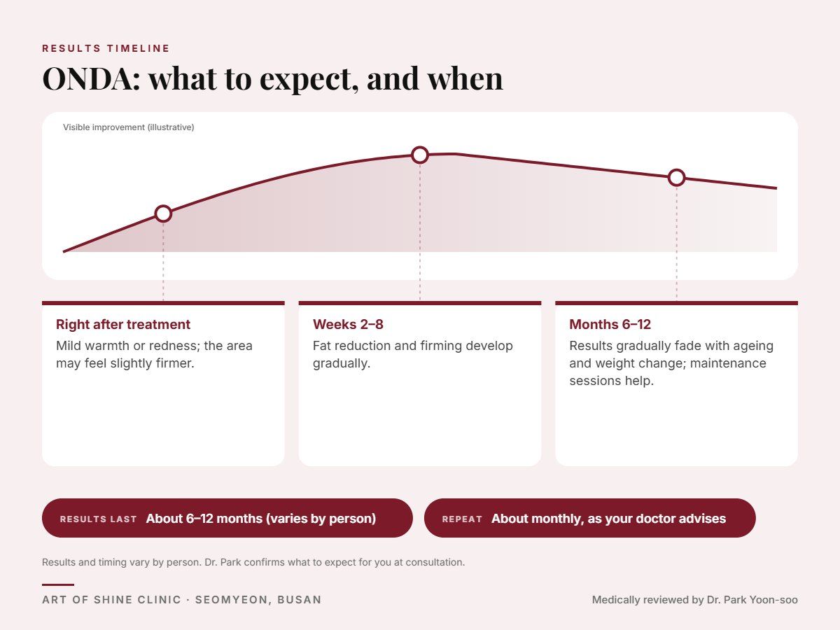 ONDA results timeline: when results appear and peak, and how long they last (About 6&ndash;12 months)