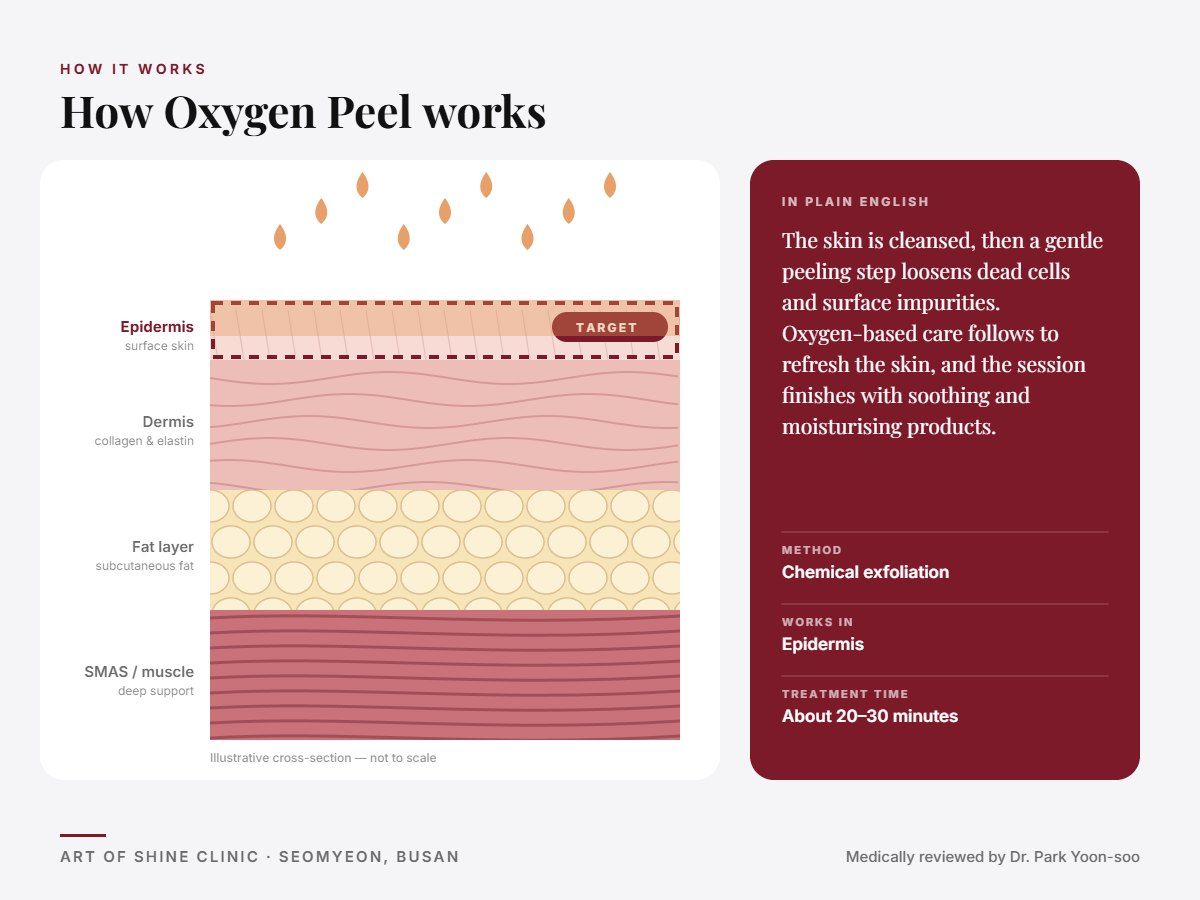 How Oxygen Peel works: illustrated skin cross-section showing chemical exfoliation reaching the epidermis (surface skin)