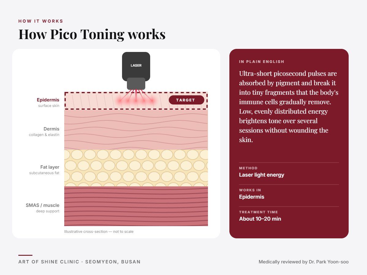 How Pico Toning works: illustrated skin cross-section showing laser light energy reaching the epidermis (surface skin)