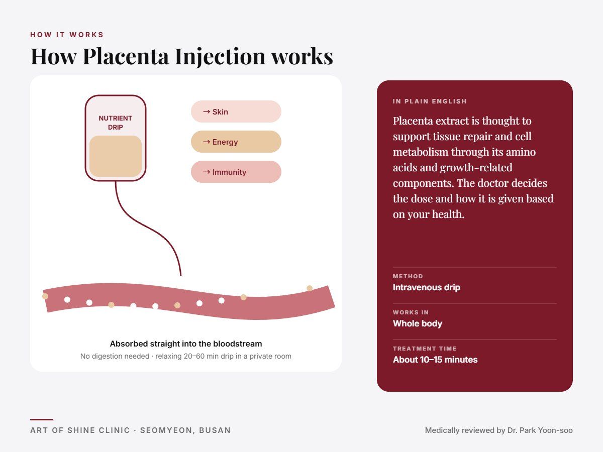 How Placenta Injection works: intravenous drip explained in a simple diagram
