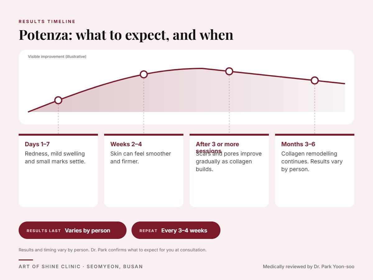 Potenza results timeline: when results appear and peak, and how long they last (Varies by person)