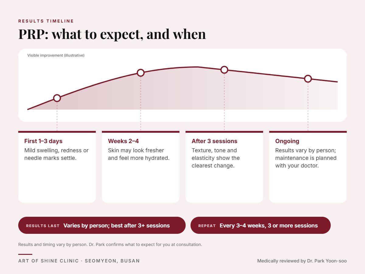 PRP results timeline: when results appear and peak, and how long they last (Varies by person; best after 3+ sessions)