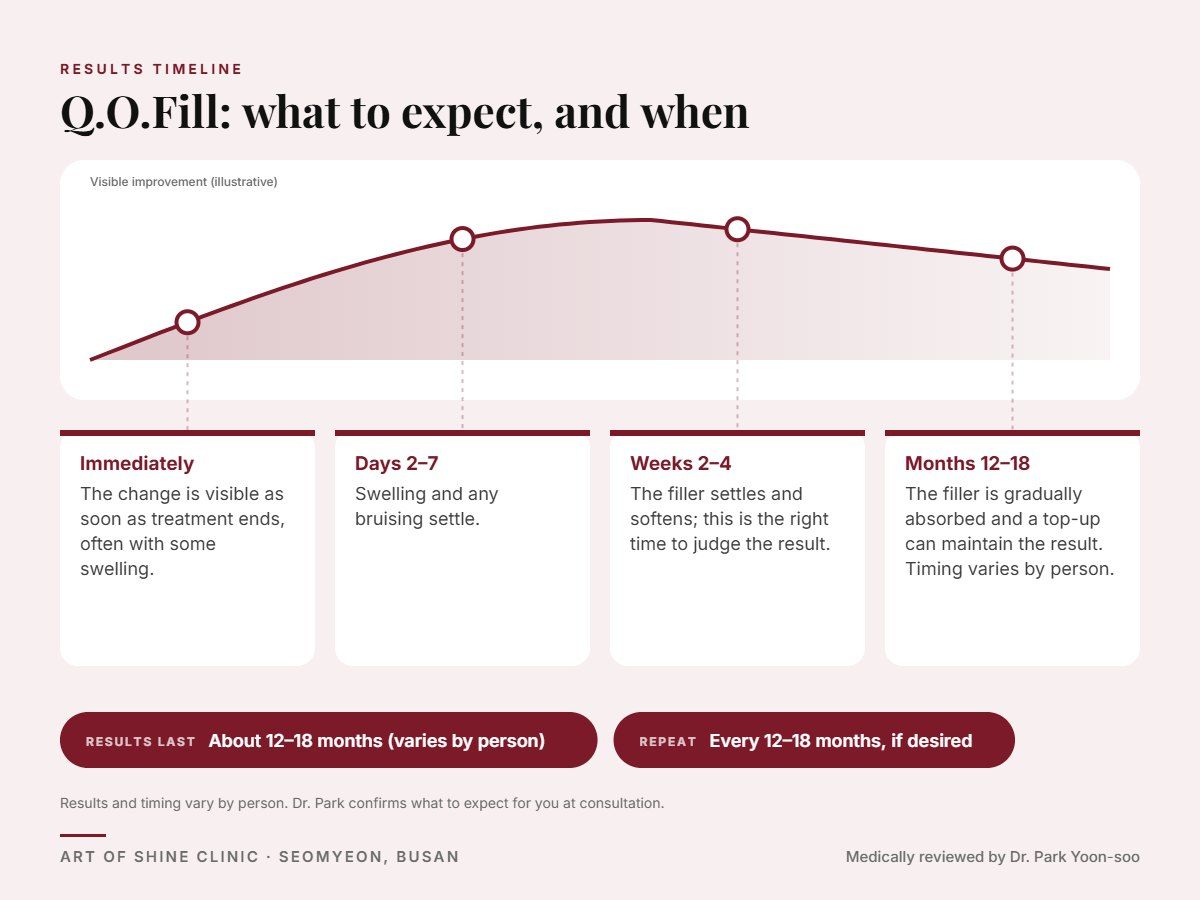 Q.O.Fill results timeline: when results appear and peak, and how long they last (About 12&ndash;18 months)