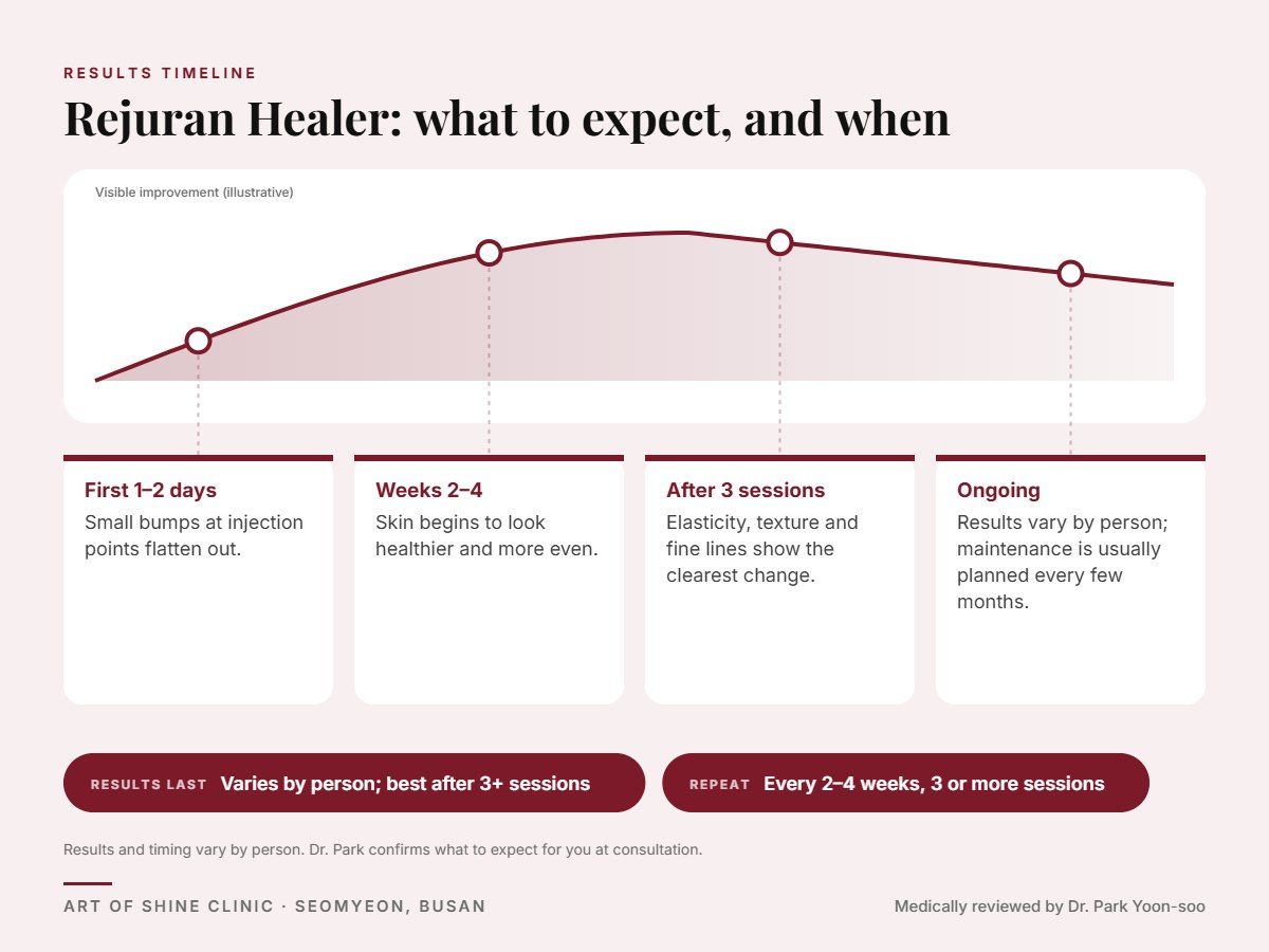 Rejuran Healer results timeline: when results appear and peak, and how long they last (Varies by person; best after 3+ sessions)