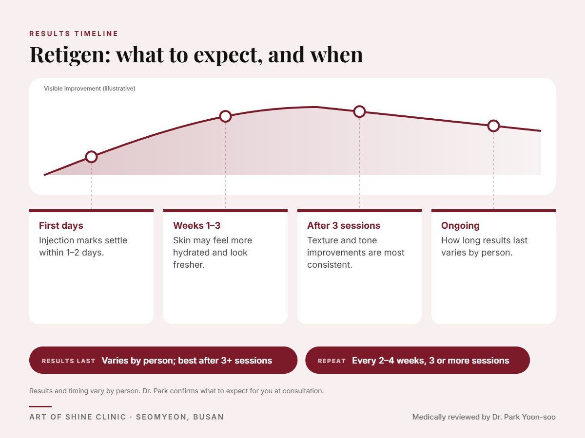 Retigen results timeline: when results appear and peak, and how long they last (Varies by person; best after 3+ sessions)
