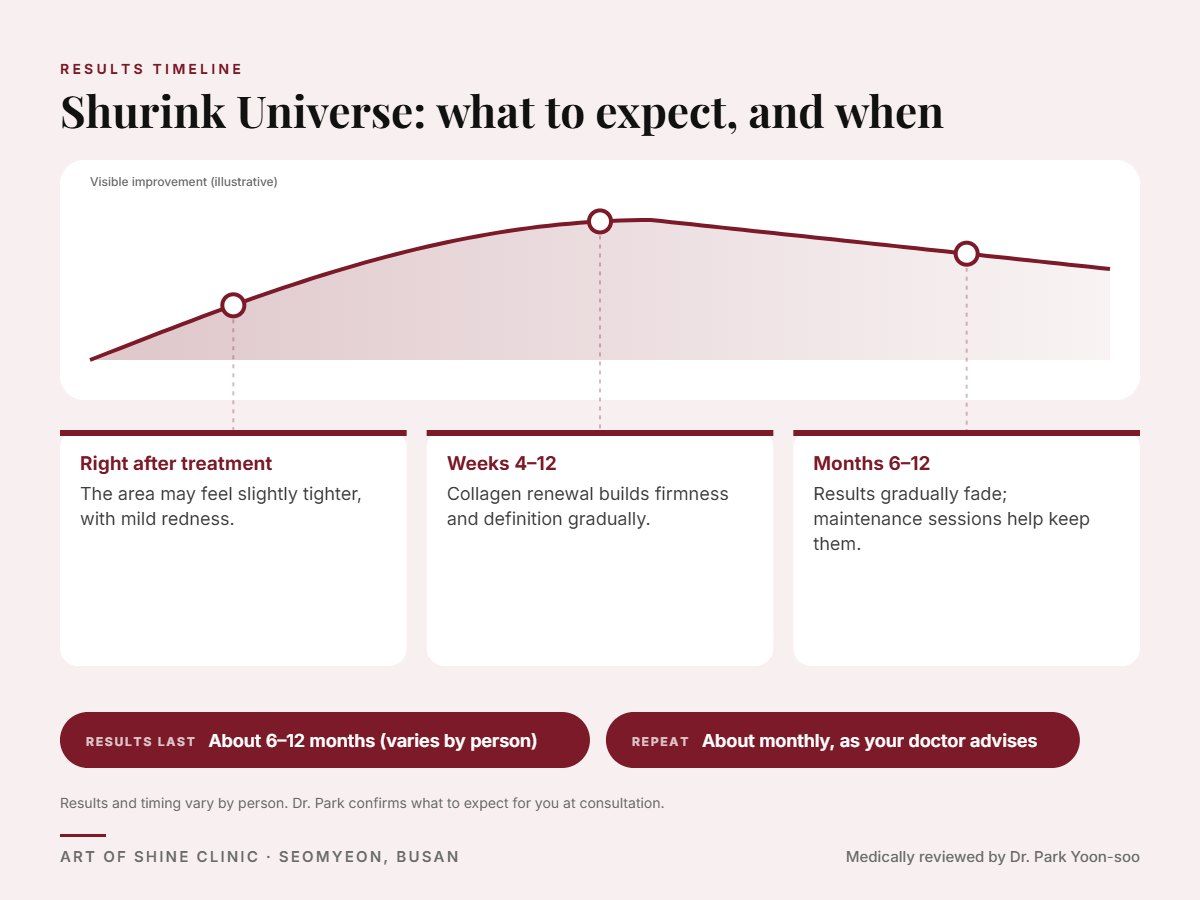 Shurink Universe results timeline: when results appear and peak, and how long they last (About 6&ndash;12 months)