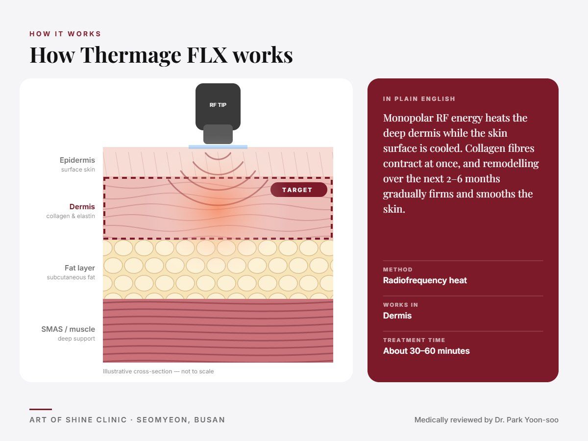 How Thermage FLX works: illustrated skin cross-section showing radiofrequency heat reaching the dermis