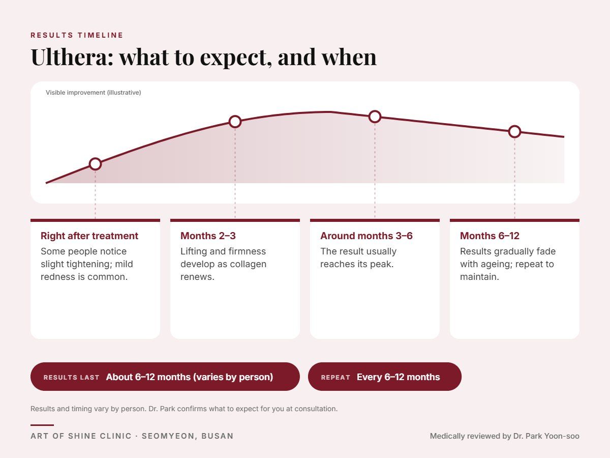 Ulthera results timeline: when results appear and peak, and how long they last (About 6&ndash;12 months)