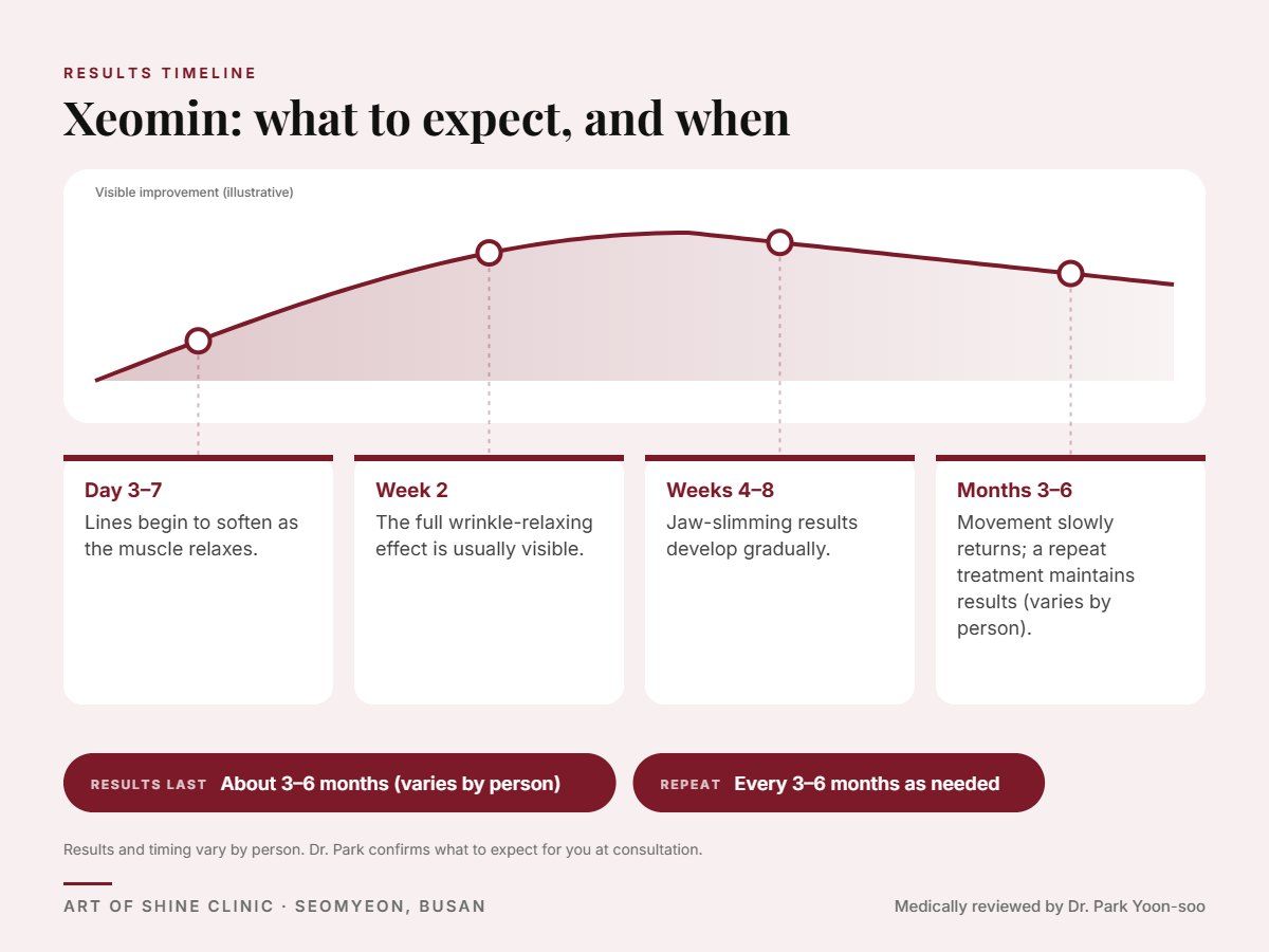Xeomin results timeline: when results appear and peak, and how long they last (About 3&ndash;6 months)