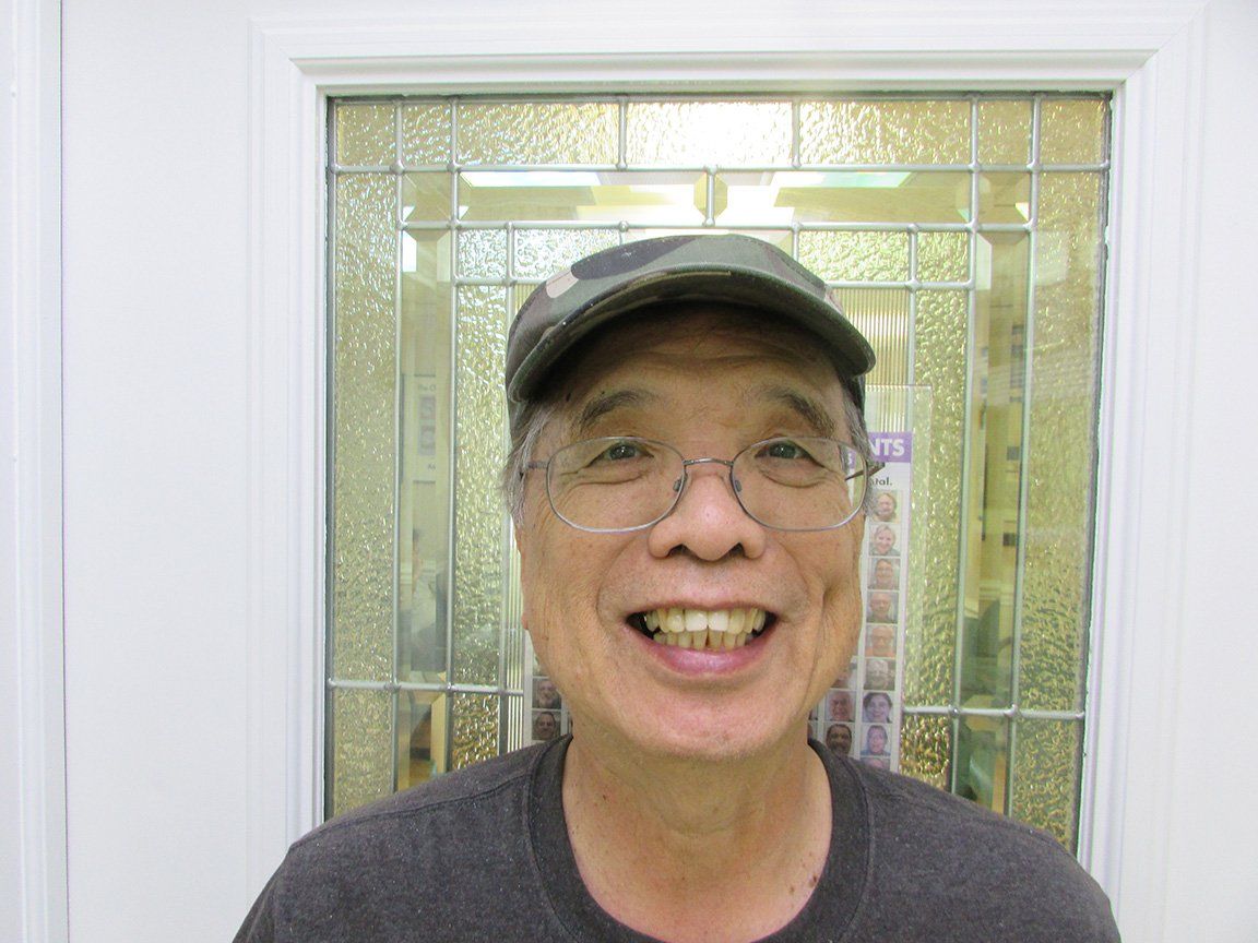 smile gallery 31