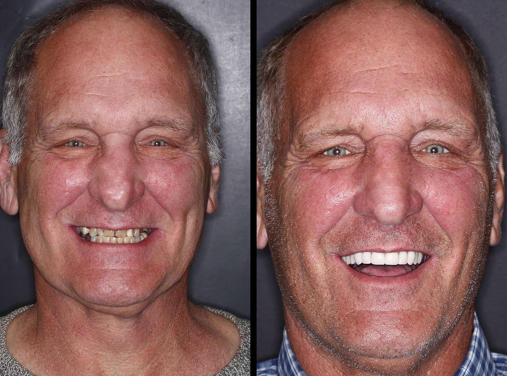smile gallery 2