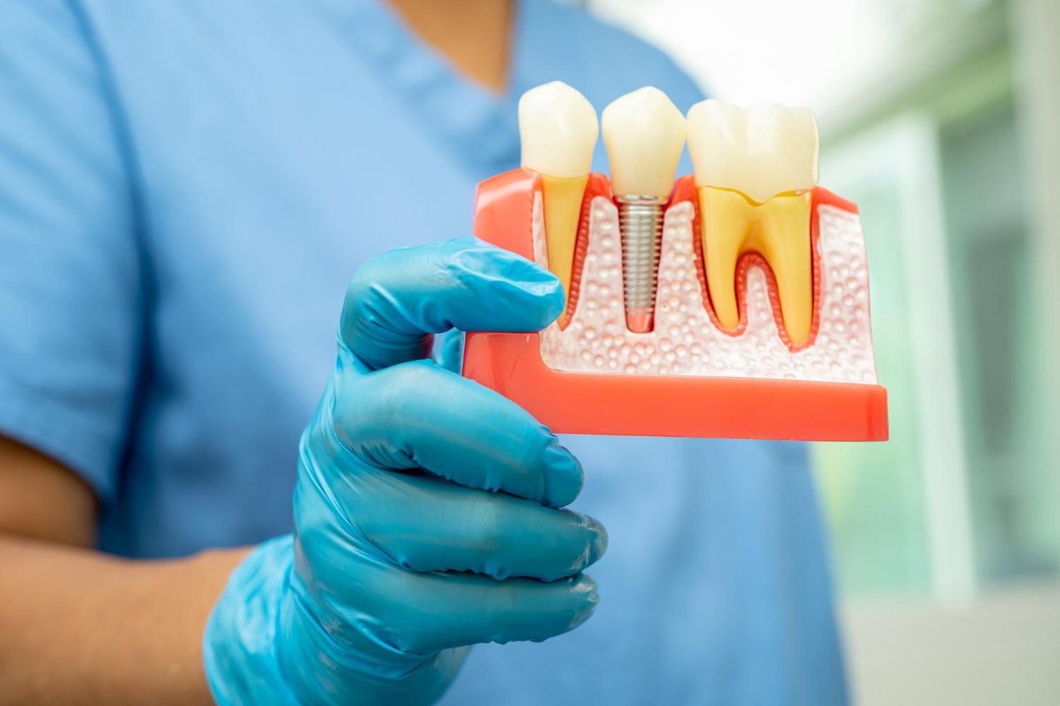 Gloved hand holding a dental model with teeth and gums, with visible root canals