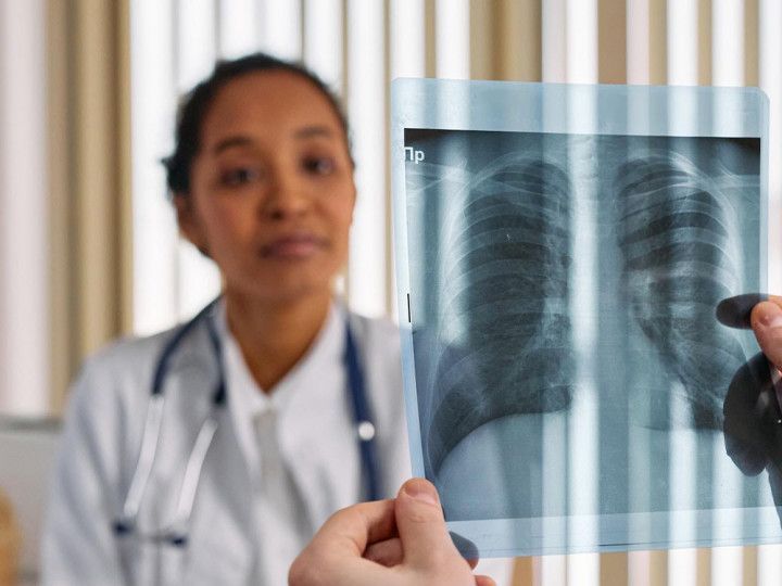 Showing Xray Result Showing Xray Result