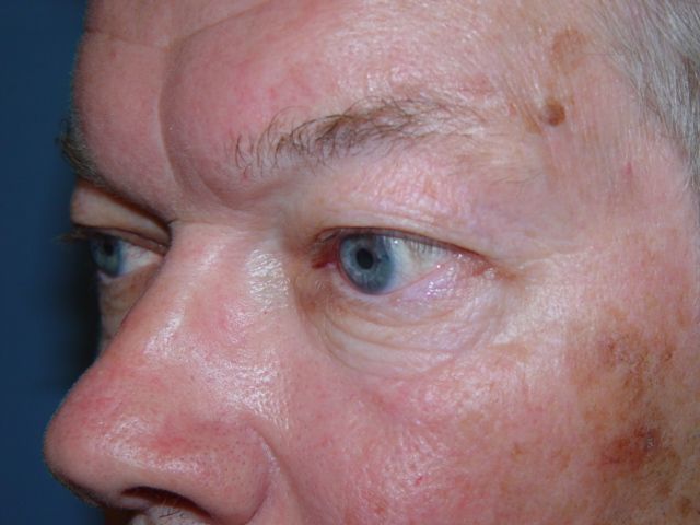 A close up of a man 's face with blue eyes.