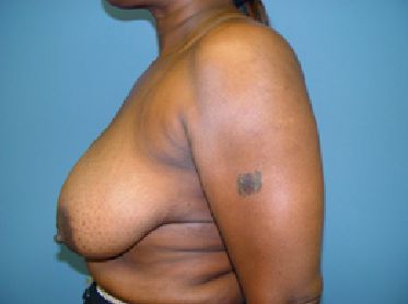 A woman without a shirt has a tattoo on her arm.
