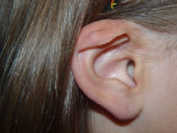 A close up of a person 's ear with brown hair.