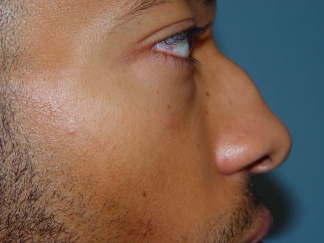 A close up of a man 's face with a blue background