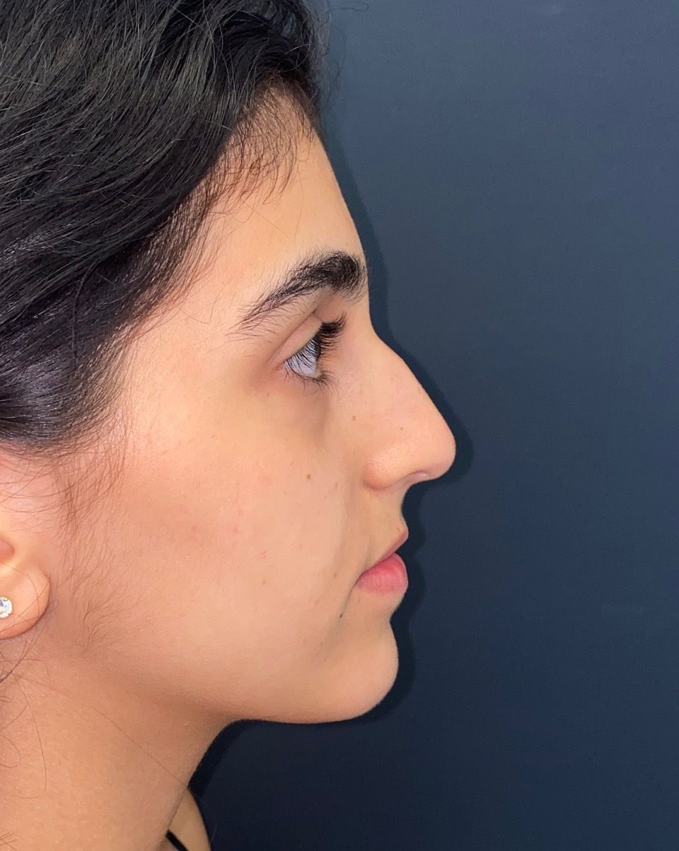 A close up of a woman 's face with a blue background.
