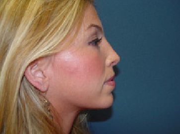 A close up of a woman 's face with a blue background.