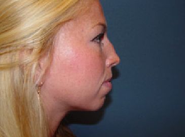 A close up of a woman 's face with a blue background.