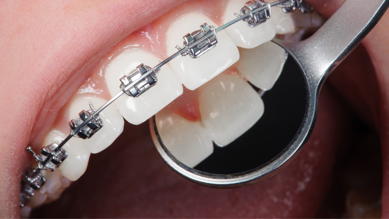 ORTHODONTICS