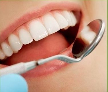 disegno di un dente avvitato in un impianto