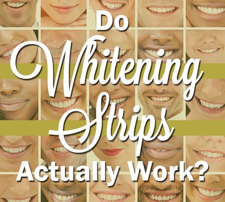 Lawrenceville dentist, Dr. Maxim Godko, answers the frequently asked question, “Do whitening strips actually work?”