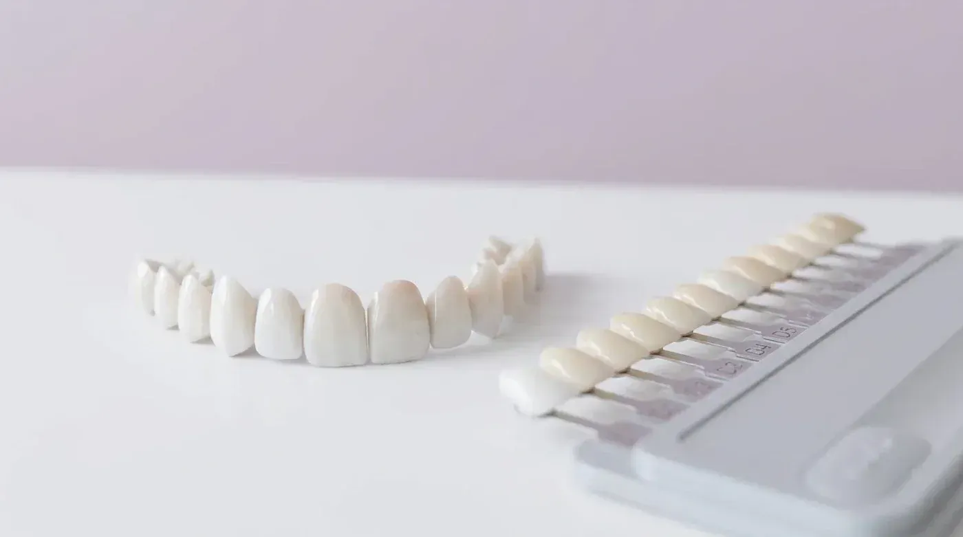A set of porcelain veneers beside a dental shade guide, used to design a brighter, even smile