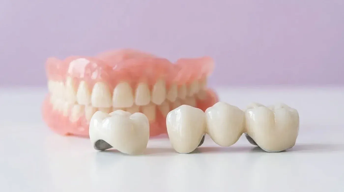 A full denture, a dental bridge and a crown, the restorations prosthodontic care provides